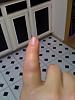 Broken Finger-brokenfing1.jpg